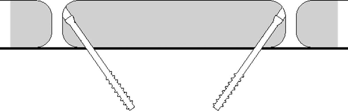 008174212_1
