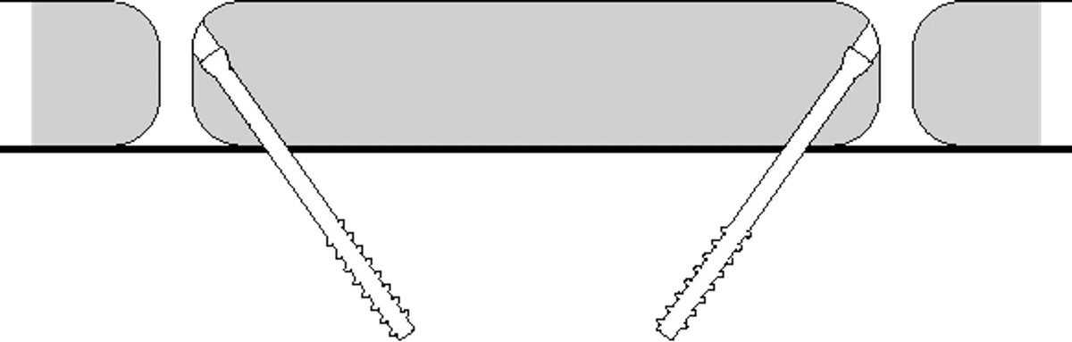 006594581_1